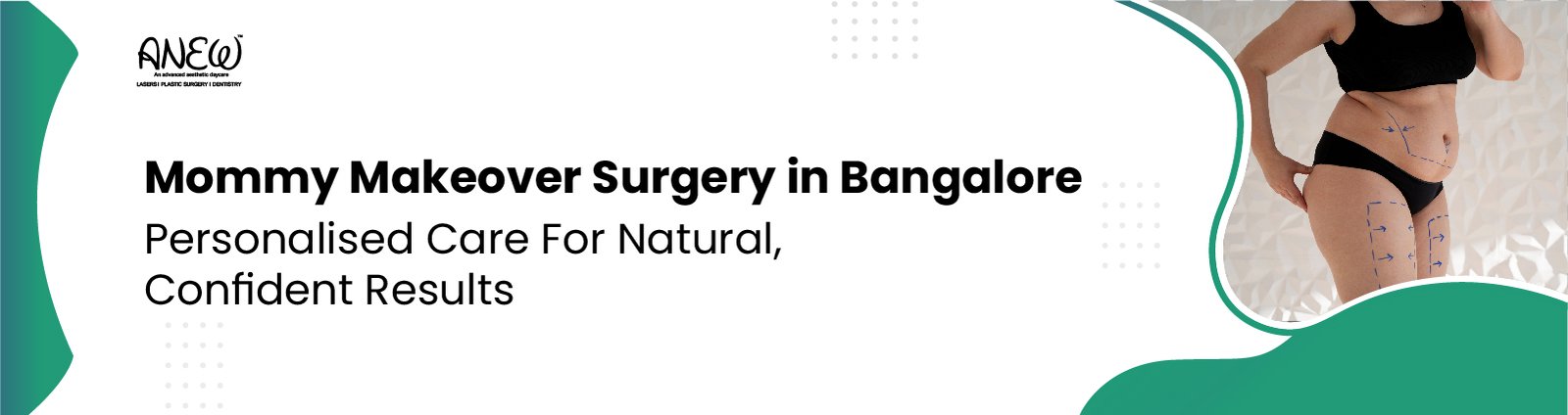 mommy makeover surgery in bangalore